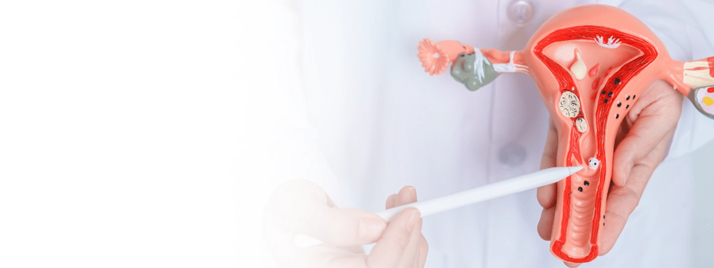 Ovarian Cyst Removal Surgery in India: Laparoscopic Procedure, Cost & Recovery Details